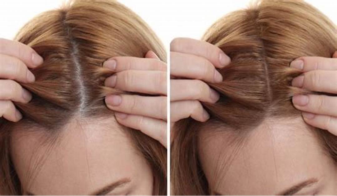 hair loss