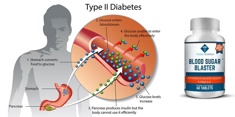 What is Blood Sugar Blaster