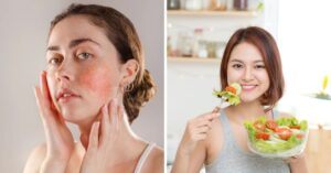 21 Best Foods To Naturally Reduce Inflammation