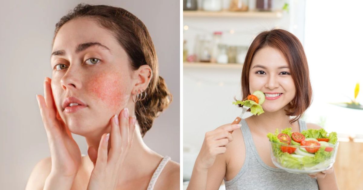 21 Best Foods To Naturally Reduce Inflammation