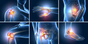 Best Supplement for Joint Pain