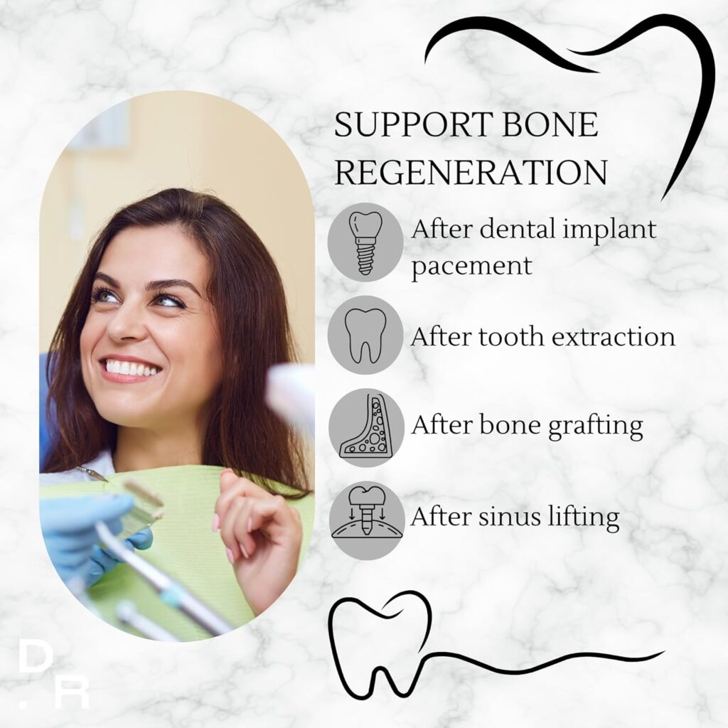 Why Bone Regeneration Is Important for Dental Implants