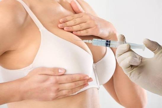 Breast Lift