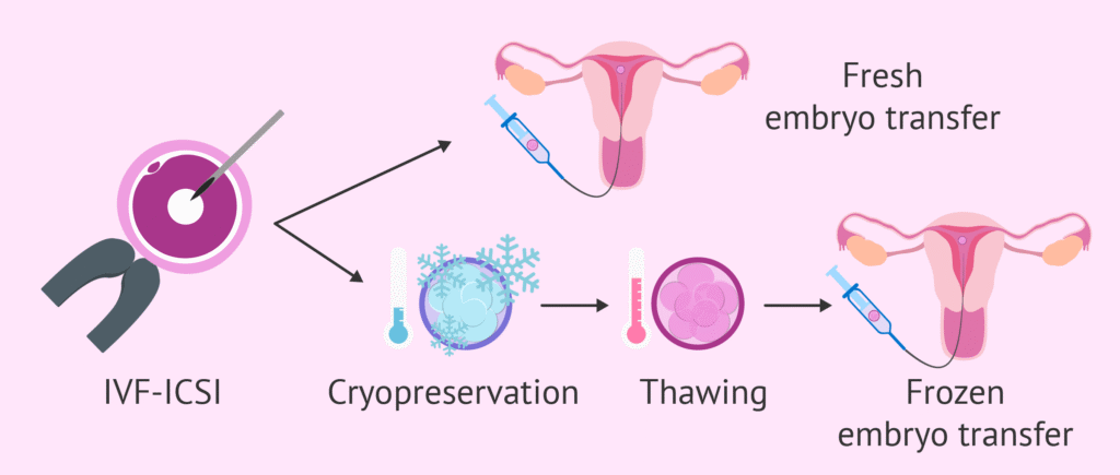 How Does Frozen Embryo Transfer Work