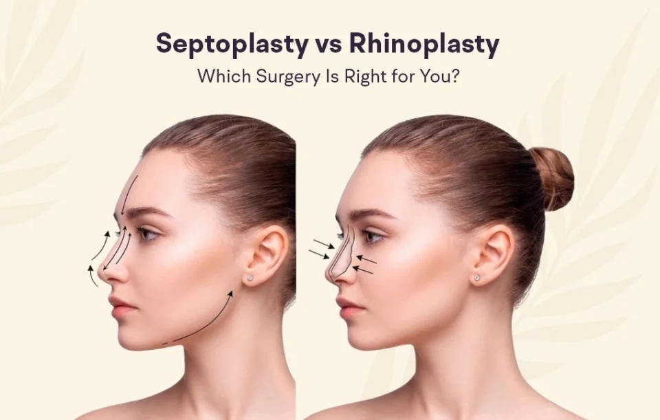 Rhinoplasty vs Septoplasty
