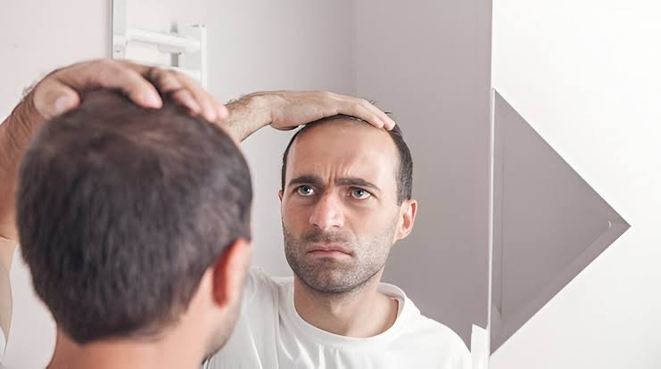 Who Is a Good Candidate for Hair Restoration
